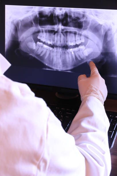 Best Emergency Tooth Extraction in Reamstown, PA