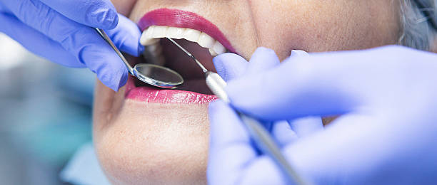 Best Emergency Wisdom Teeth Removal in Reamstown, PA